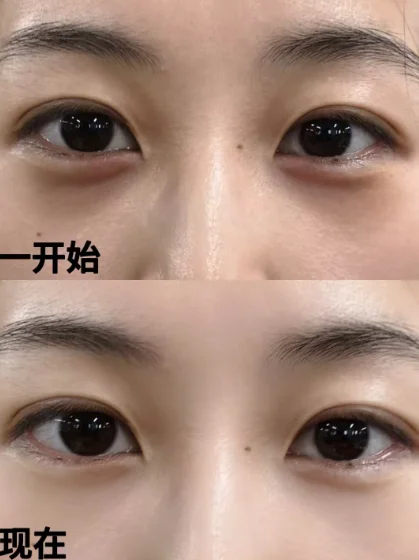 2025十款口碑好的眼霜推荐！眼霜哪个牌子去细纹好？ 敏感肌专研 推荐