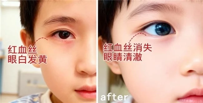 2025年权威测评!十款热门叶黄素，不搞“花架子“只做真测评! ​