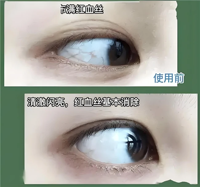 2025年权威测评!十款热门叶黄素，不搞“花架子“只做真测评! ​