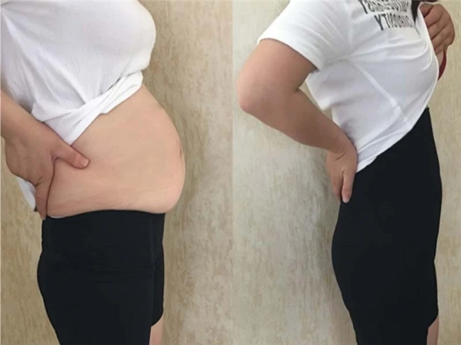 高效燃脂产品TOP10榜：减肥哪个牌子效果好，助力减脂的实用之选，点燃瘦身热血