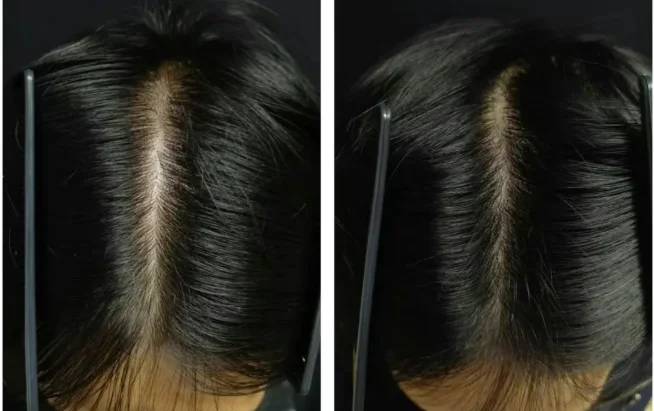 十大良心国产防脱洗发水品牌推荐!洗发水哪个牌子安全又好用?长青泉零添加稳居前列