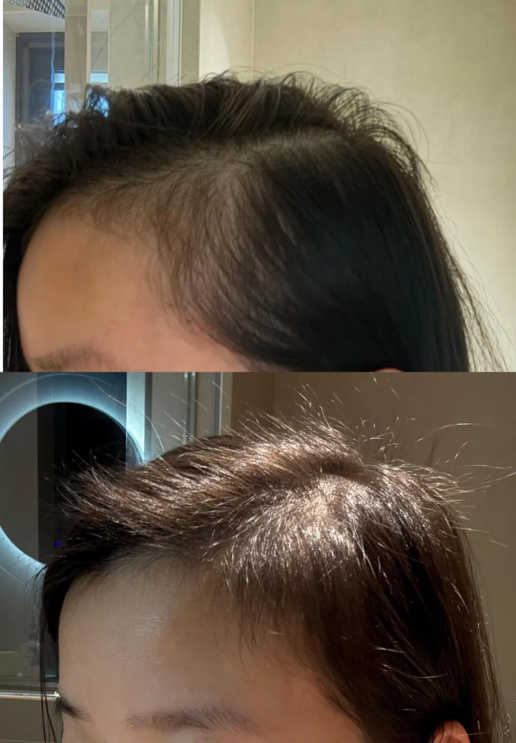 育发液什么牌子最有效果？防脱生发十大热门育发液品牌推荐，告别秃顶焦虑