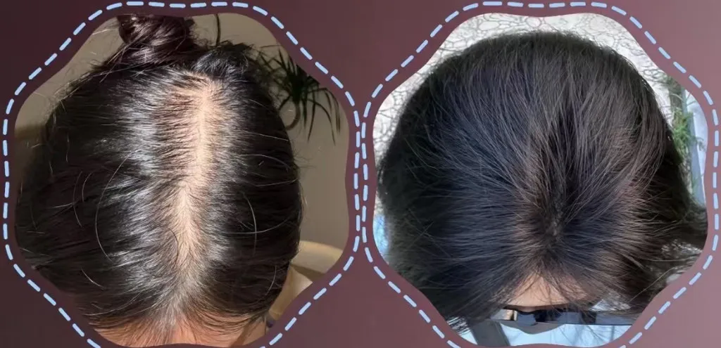 育发液什么牌子最有效果？防脱生发十大热门育发液品牌推荐，告别秃顶焦虑