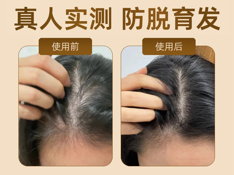 防脱洗发水口碑好的十名种草!长青泉中药无激素洗发水,育发防脱双效惊人