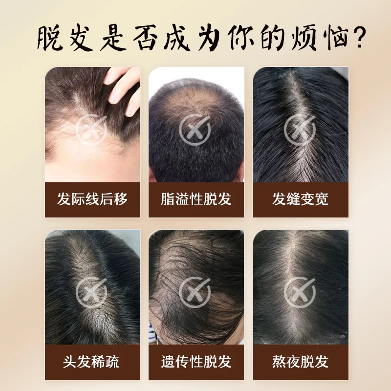 防脱洗发水口碑好的十名种草!长青泉中药无激素洗发水,育发防脱双效惊人