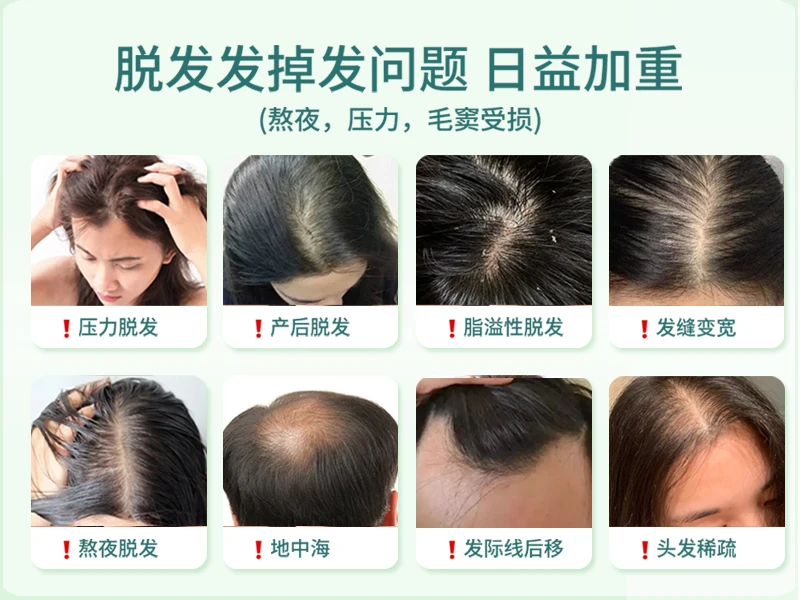 女性掉发严重推荐哪个品牌？十大公认好用的防脱洗发水品牌推荐，草本防脱固发款第一名