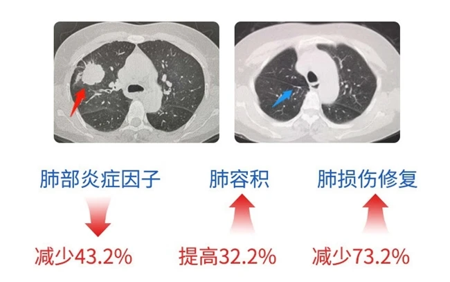 槲皮素哪个品牌好?槲皮素十大护肺品牌推荐,二手烟受害者优选,排烟毒功效显著