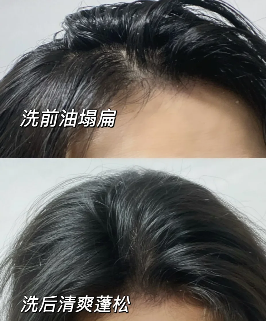 拯救大油头!2026超强控油蓬松洗发水盘点
