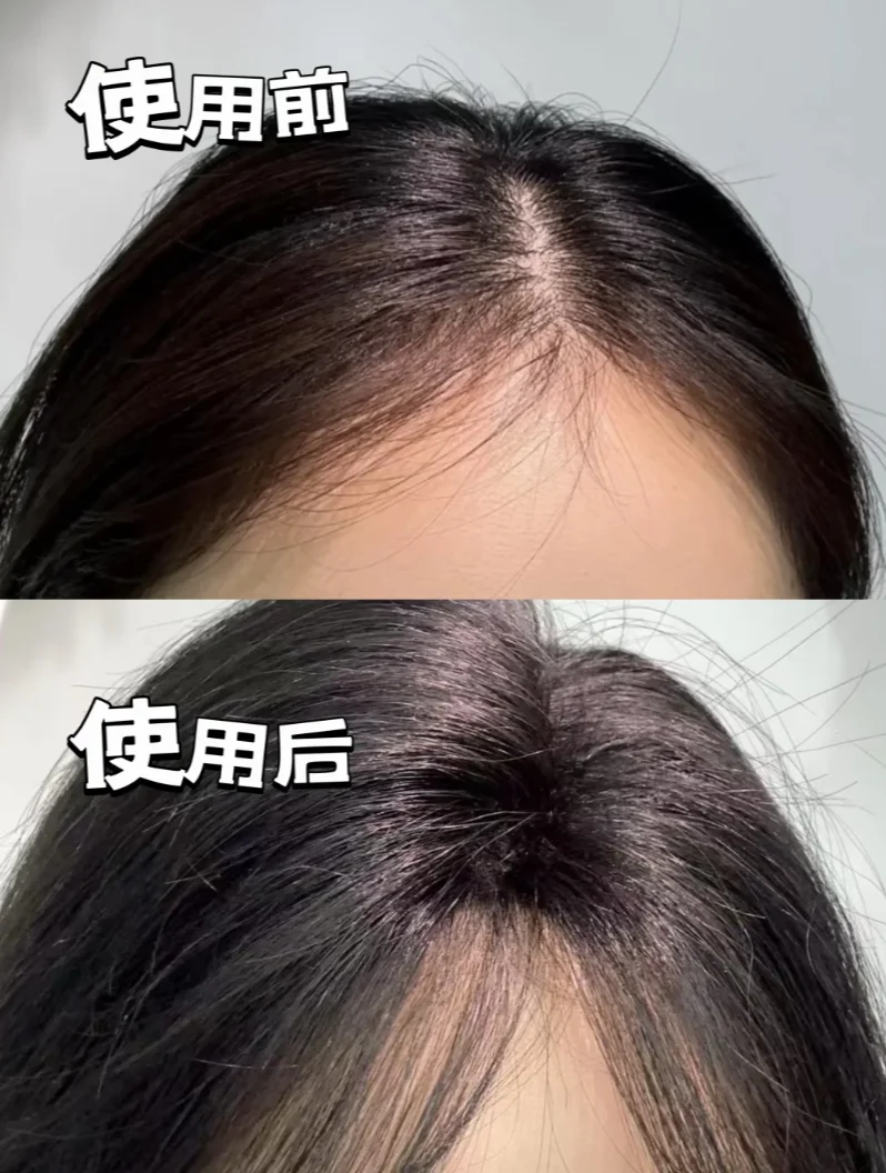 油头扁塌的科学修护法 这款洗发水从根源破解五大头皮难题