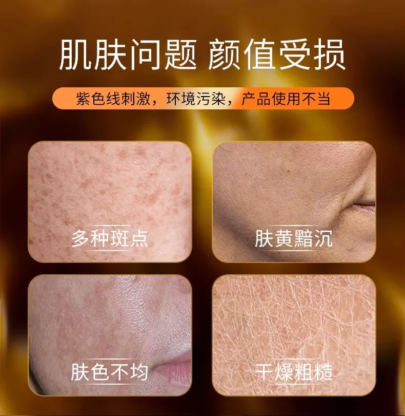 敏感肌美白祛斑面霜怎么选？2026年国妆特证产品深度测评：后西施能否兼顾淡斑与修护？精准淡斑+黄褐斑淡化超明显