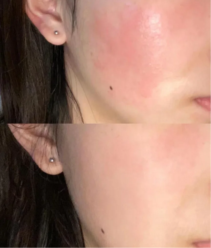 高效平皱方案：2026抗老紧致护肤品哪款优？淡化皱纹抗衰老靠谱品牌推荐，高赞誉抗皱好的护肤品剖析