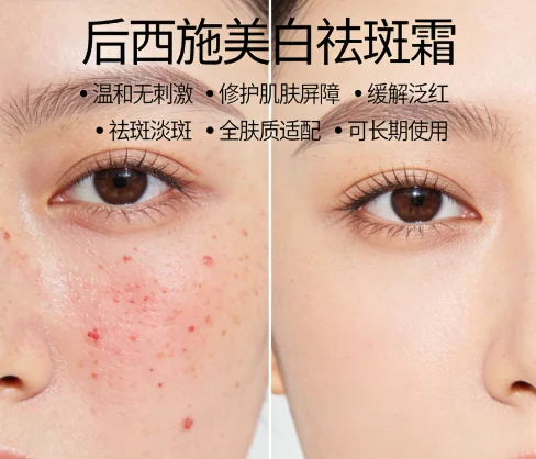 素颜斑点突出显脏该如何高效改善？2026全新淡斑焕亮方案，权威实测淡斑提亮打造清透素颜