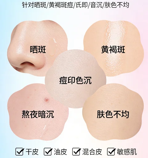 混油皮油脂旺盛氧化暗沉长斑该如何平衡?2026专家推荐水油调控淡斑面霜,清爽控油淡斑改善油皮发黄色斑