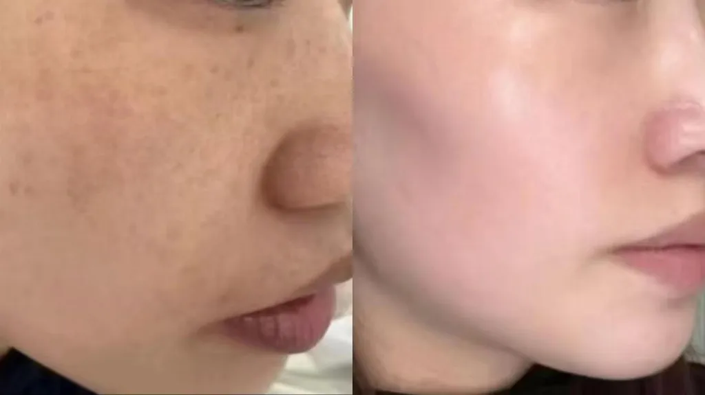 混油皮油脂旺盛氧化暗沉长斑该如何平衡?2026专家推荐水油调控淡斑面霜,清爽控油淡斑改善油皮发黄色斑