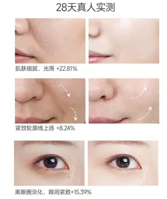 春夏抗老护肤排行榜热门单品选哪套最稳？儒曼抗皱紧致套装，保湿抗皱舒缓维稳长期位居榜单前列