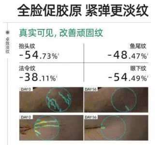 什么护肤品抗皱效果好?618抗衰老产品推荐!2026高口碑抗皱淡纹护肤品盘点:精准修护肌底,解锁年轻通透肤质